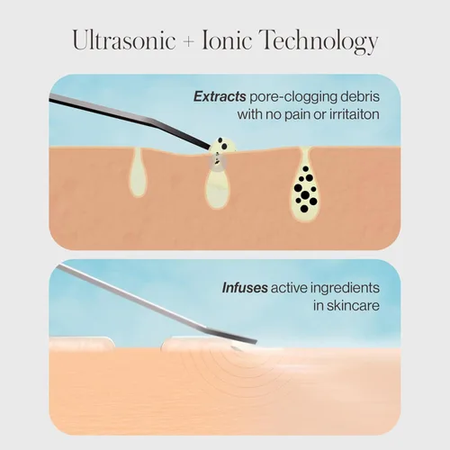Miniatura 9 de DERMAFLASH DERMAPORE+ Dispositivo de cuidado de la piel, extractor ultrasónico de poros 2 en 1 e infusor para el cuidado de la piel, rubor