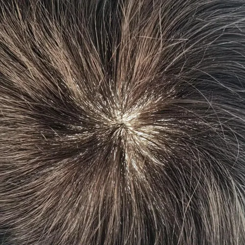 Miniatura 3 de Toupee - Sistema de reemplazo de cabello de polietileno completo para hombre, cabello humano europeo para hombre, tupé de 0.004 in, piel duradera