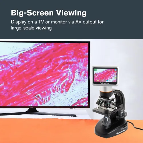 Miniatura 8 de Celestron – Microscopio digital LCD TetraView – Pantalla de 4.3" – Cámara de 5MP – Aumento de 40x–1600x – Cabezal giratorio – Tarjeta SD incluida