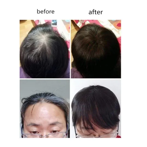 Miniatura 4 de Extensiones de cabello humano real con clip con flequillo, peluca para cabello fino para mujer (8 pulgadas, marrón oscuro)