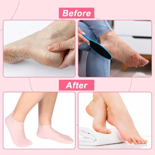 Miniatura 6 de SATINIOR 3 pares de calcetines de silicona para pies secos y agrietados, para terapia de pies, spa, pedicura, calcetines de silicona reparadores