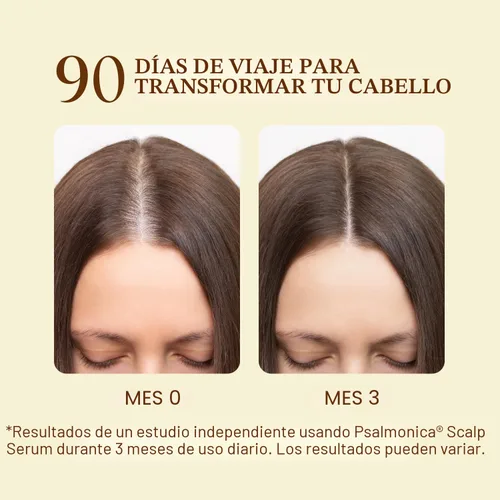 Miniatura 5 de Suero para el crecimiento del cabello: aceite de ricino de batana de romero, agua de arroz, aceites capilares de biotina para el crecimiento