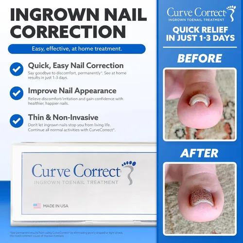 Miniatura 4 de Tratamiento del hogar para uñas encarnadas CurveCorrect
