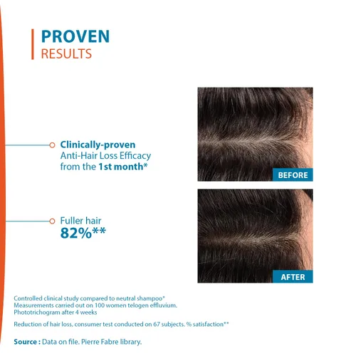 Miniatura 5 de Ducray Creastim Reactiv Loción para la pérdida del cabello 2.0 fl oz