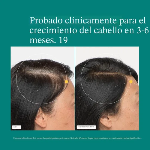 Miniatura 4 de Nutrafol - Suplementos de crecimiento del cabello para mujeres de 18 a 44 años, clínicamente probados para cabello visiblemente más grueso y fuerte