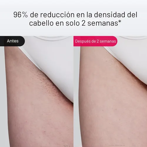 Miniatura 4 de Ulike Depilación láser Air 10 Deluxe Version IPL para mujeres y hombres con tecnología de enfriamiento de hielo, Nealy sin dolor y reducción