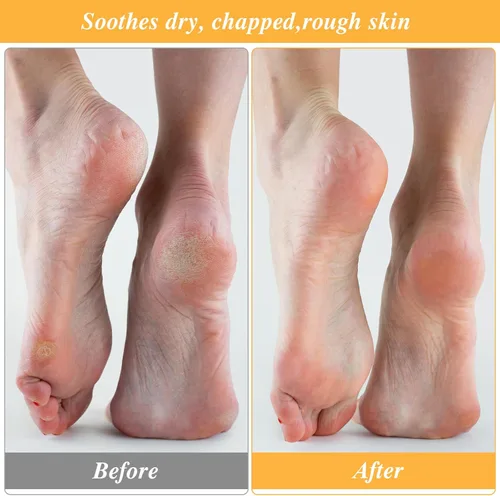 Miniatura 5 de 3 pares de calcetines hidratantes para pies secos, reparación de talón agrietado, calcetines de algodón de loción durante la noche, gel spa mejora