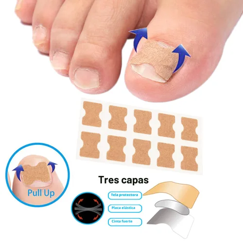 Miniatura 3 de Juego de corrector de uñas encarnadas con tiras de corrección,Kit de herramientas profesional de uñas encarnadas,Parche corrector de uñas