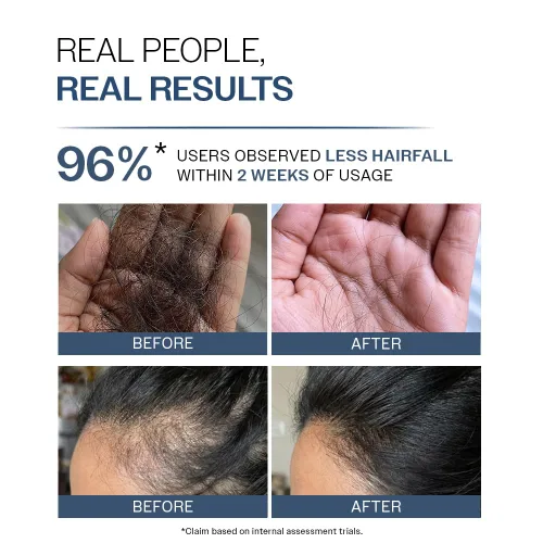 Miniatura 5 de Bare Anatomy Champú anticaídas Proporciona 5 veces control de caída del cabello pH 4.6 Adenosina y péptidos Fortalece las raíces débiles