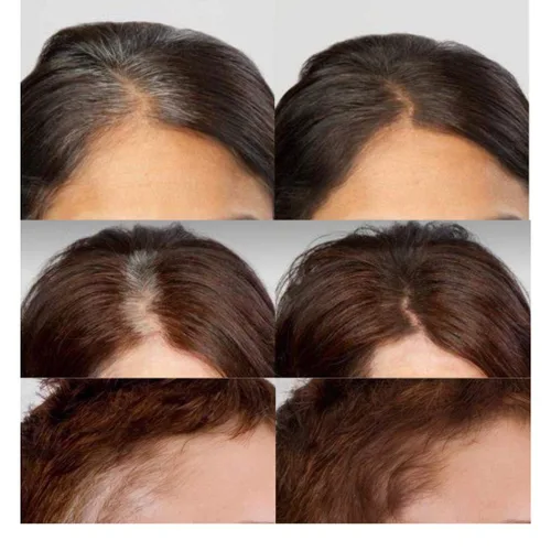 Miniatura 5 de Corrector de cabello gris para retoque de raíz, cobertura de raíces marrón claro