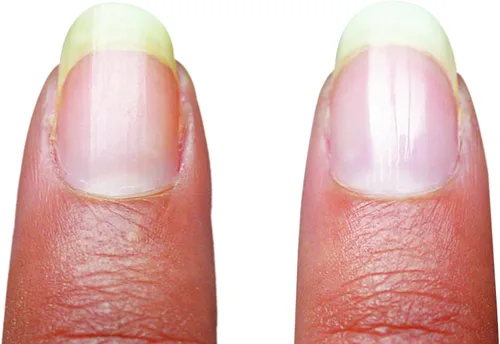 Miniatura 5 de Emjoi Manicura micro de uñas o manicura pedi: suaviza, pule y brilla al instante