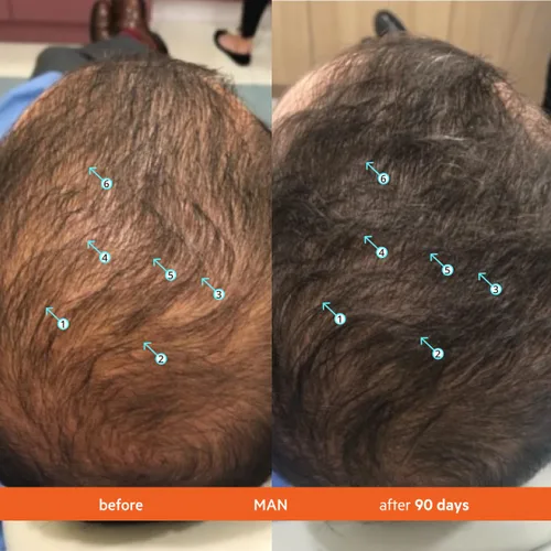 Miniatura 3 de Revita Tablets Vitaminas para el crecimiento del cabello de DS Laboratories, promueve el crecimiento del cabello en mujeres y hombres, experimenta