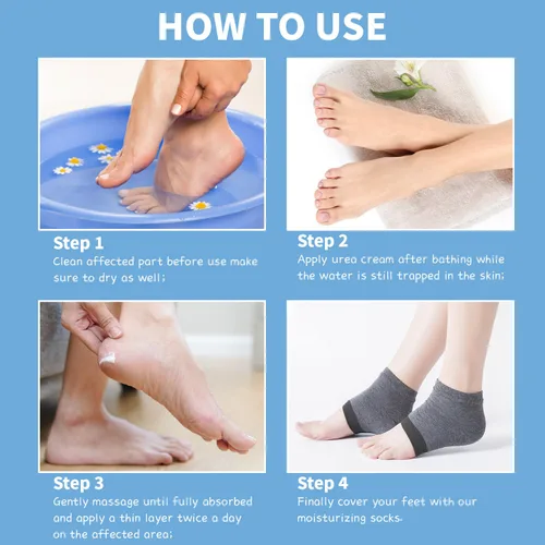Miniatura 6 de Crema de urea 60% – Crema de pies de urea con calcetines hidratantes para el talón para manos secas agrietadas, 60 por ciento para pies de máxima