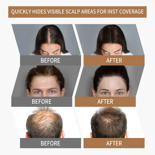 Miniatura 2 de Polvo para Línea de Cabello Sevich 2.0, Oculta Instantáneamente la Pérdida de Cabello, Polvo para Toque de Raíces, Sombra de Cabello para Mujeres