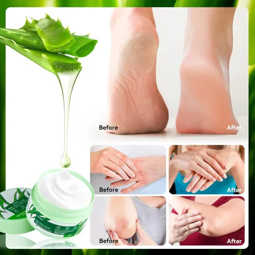 Miniatura 5 de Crema de urea 42 por ciento para pies, 7.0 onzas, 2% ácido salicílico, aloe vera, ácido hialurónico, crema hidratante profundamente para pies secos