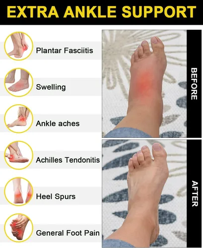 Miniatura 2 de 5 pares de calcetines de compresión de cobre para mujeres y hombres, calcetines de tobillo para fascitis plantar con soporte de arco para atletismo