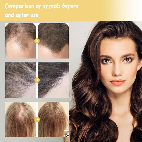 Miniatura 3 de Champú de aceite de Batana,Aceite de batana para el crecimiento del cabello,Champú DeBatana Para La Caida Del Cabello,Champús contra la pérdida