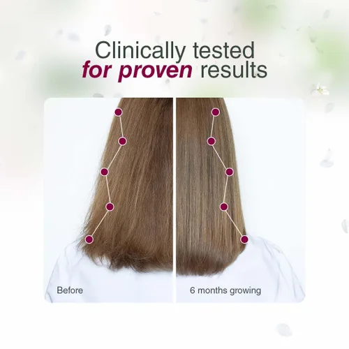 Miniatura 2 de Bellahair Revive, fortalece y brilla con nuestro lujoso aceite natural para el cabello, alimentado por aceite de amaranto para el crecimiento