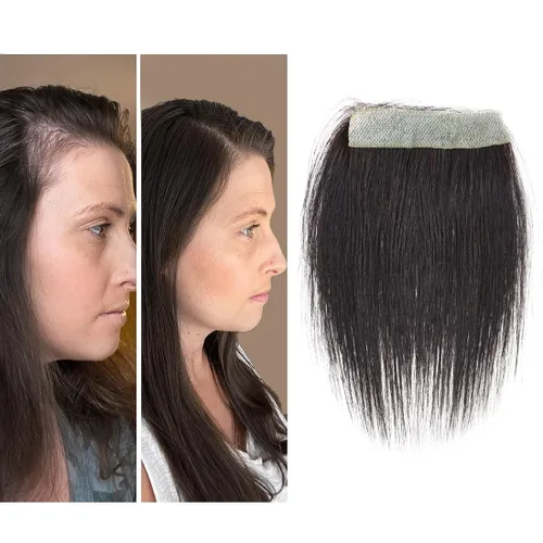 Miniatura 10 de Reemplazo de cabello humano con cicatrices, quemaduras accidentales sin vello para hombres y mujeres, pérdida de línea de cabello, cinta recta
