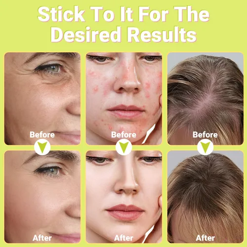 Miniatura 5 de Uaike - Varita facial de alta frecuencia, portátil, de mano, de alta frecuencia, con 4 tubos de vidrio naranja, dispositivo de varita facial