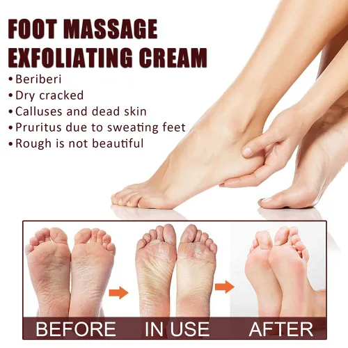 Miniatura 3 de Crema reparadora de pies de manteca de karité, ungüento curativo de la piel para talones agrietados y pies secos Crema exfoliante para masaje de 1