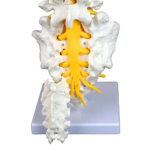 Miniatura 6 de Columna vertebral lumbar articulada de grado médico VAV262 Cuenta con 5 lumbares/vértebras con discos intervertebrales, nervios lumbares y médula