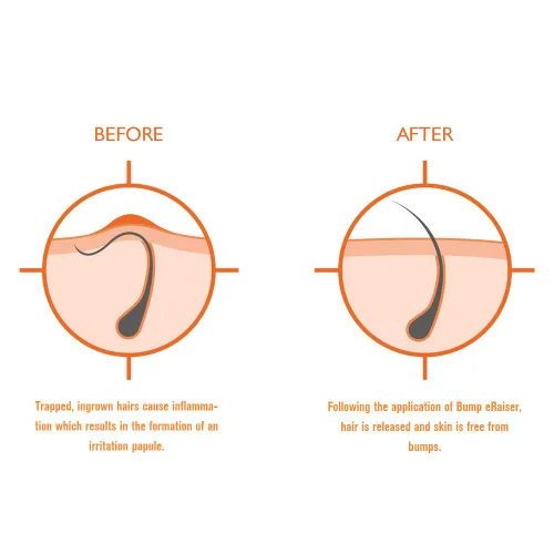 Miniatura 2 de Bump eRaiser Loción calmante de triple acción para el tratamiento del cabello encarnado, protuberancias de afeitar y quemaduras de maquinilla