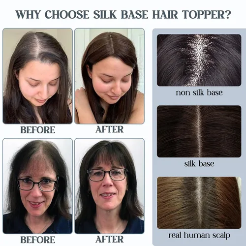 Miniatura 5 de Benehair Toppers de cabello humano para mujer, 100% cabello humano Remy, densidad del 150%, sin flequillo, 2.8 x 5.1 in, base de seda, piezas