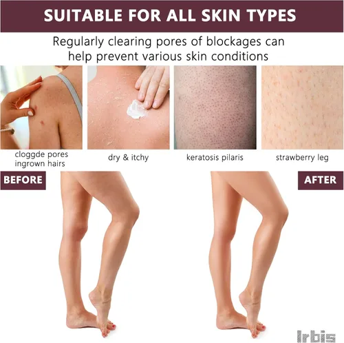 Miniatura 3 de Irbis Guante exfoliante profundo, guante coreano, exfoliante corporal, removedor de piel muerta, esponja de baño de doble textura y toallita, ideal