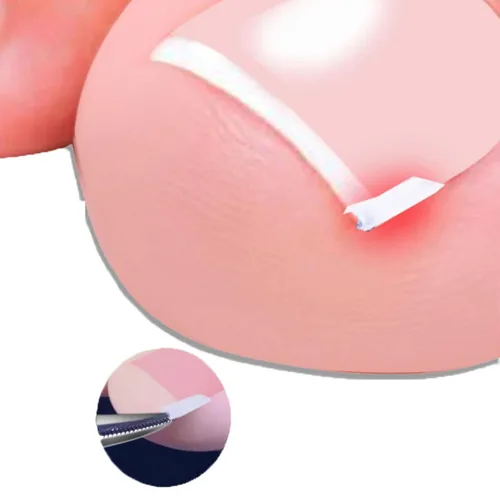 Miniatura 9 de Kit de 10 tiras correctoras de uñas encarnadas blancas, herramienta de pedicura gruesa, tira alisadora de uñas para hombres y mujeres, herramienta