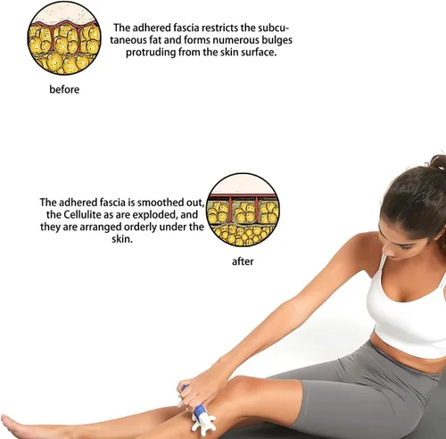 Miniatura 7 de DARKRING Herramienta de masaje de punto de presión, herramienta de masaje de tejido facial y punto de gatillo gua sha para aliviar la fascia