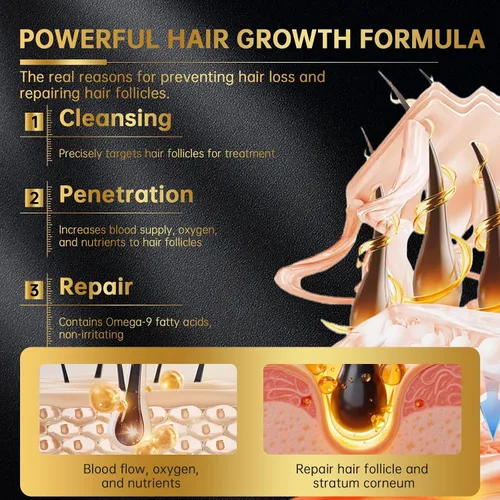 Miniatura 6 de Solución tópica de minoxidil USP 5% para hombres y mujeres - Tratamiento de crecimiento capilar OTC, fármaco monográfico de la FDA, fórmula no grasa