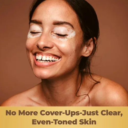 Miniatura 5 de Dermawonder - Cápsulas de vitiligo (60 unidades) Suplemento eficaz de vitíligo, reduce las manchas blancas y mejora el apoyo de la pigmentación