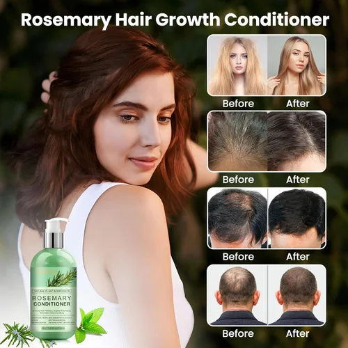 Miniatura 2 de Acondicionador de romero para el crecimiento del cabello: tratamiento para el adelgazamiento del cabello y contra la caída del cabello para hombres