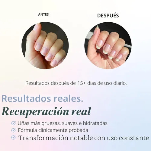 Miniatura 2 de Sistema de crecimiento de uñas dURI Rejuvacote, de 61 onzas