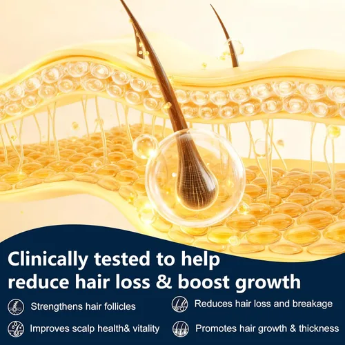 Miniatura 7 de Champú activador de raíces para hombres y mujeres, champú anti pérdida de cabello y crecimiento del cabello para hombres con ingredientes herbarios