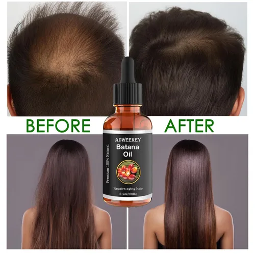Miniatura 7 de Aceite de batana orgánico para el crecimiento del cabello, 100% puro, promueve el bienestar del cabello para hombres y mujeres, mejora el brillo
