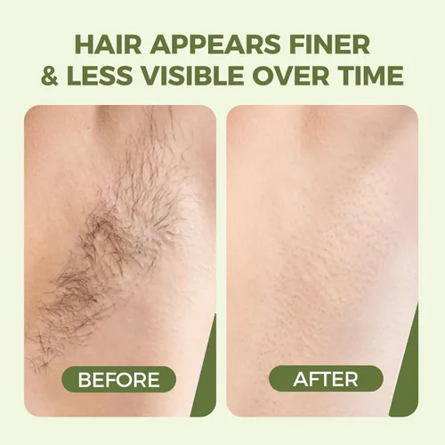 Miniatura 4 de Cyperus Rotundus Aceite para depilación – Aceite orgánico de rotondo de ciprés prensado en frío para ayudar a reducir la apariencia de cabello