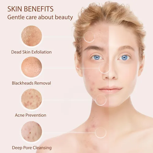 Miniatura 4 de Cepillo de Limpieza Facial Exfoliante para el Rostro Limpiador Exfoliante para el Cuidado de la Piel Lavado para Mujeres Niñas Exfoliante Eléctrico