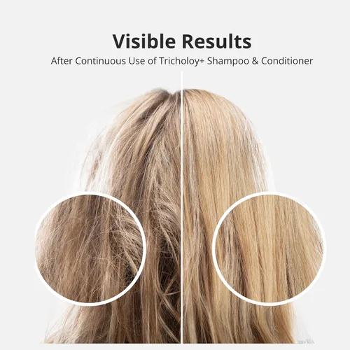 Miniatura 6 de Champú voluminizador y espesante para cabello fino y fino, fórmula de biotina Root Lift añade cuerpo instantáneo, plenitud y brillo, sin sulfato, 10