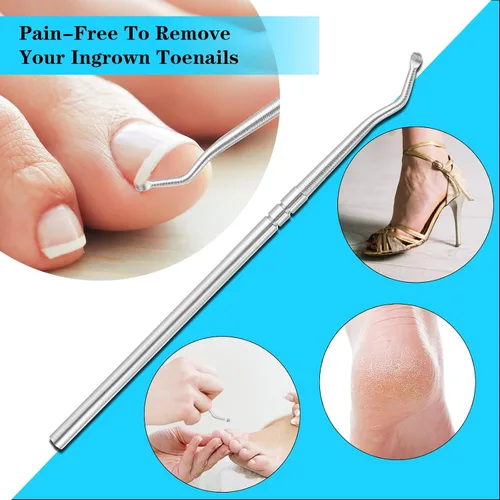 Miniatura 4 de (50+1) Juego de corrector de uñas encarnadas, kit profesional de eliminación de uñas encarnadas sin dolor con levantador de uñas de los pies, tira