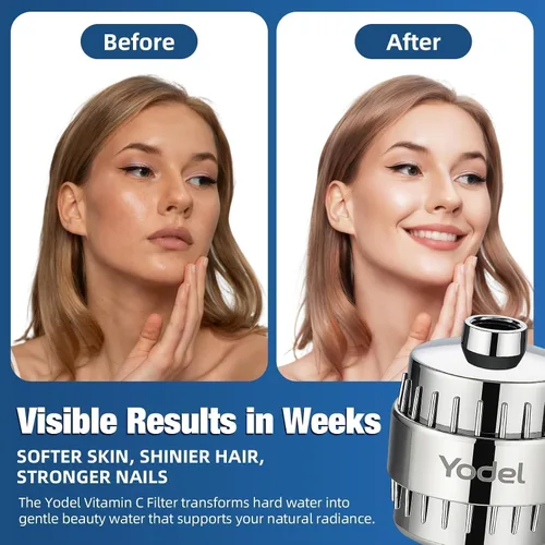 Miniatura 4 de Yodel Filtro de ducha para agua dura, filtro de cabezal de ducha de 25 etapas que elimina el cloro para el cabello y la piel, reduce la piel seca