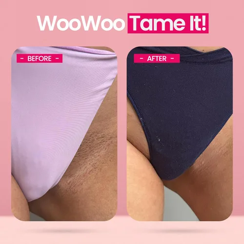 Miniatura 5 de WooWoo Crema natural de depilación íntima - Removedor de pelo vegano sin dolor para pieles sensibles - Depilatorio para genitales, bikini, piernas
