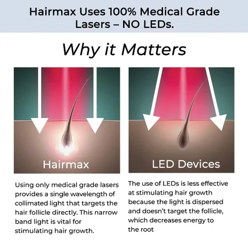 Miniatura 4 de Hairmax LaserBand 82 - Tratamiento para el Crecimiento y Rebrotes del Cabello - Restaura el Ciclo Natural del Cabello - Dispositivo Médico de Uso