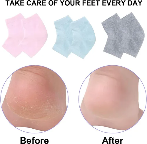 Miniatura 4 de Calcetines de talón de gel hidratante ventilados, 3 pares de calcetines de spa sin dedos para tratamiento de cuidado de pies, talones agrietados