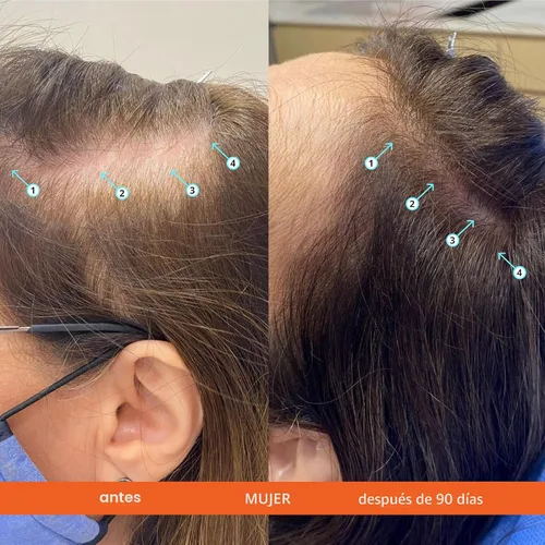 Miniatura 5 de DS Labs - Kit de champú y acondicionador Revita para hombres y mujeres, sistema de cuidado del cuero cabelludo de dos pasos para cabello