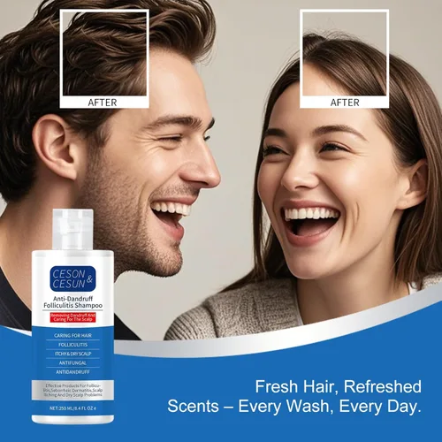 Miniatura 10 de Ceson&Cesun Champú 2 en 1 antifúngico/anticaspa para foliculitis, psoriasis del cuero cabelludo y dermatitis seborreica, alivio de la picazón