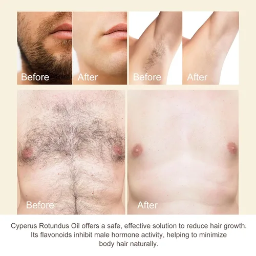 Miniatura 8 de Cyperus Rotundus Oil Hair Inhibitor Serum 2Pcs, Natural Painless Hair Removal for Women & Men, Slow Body & Facial Hair Regrowth, Moisturize Soothe