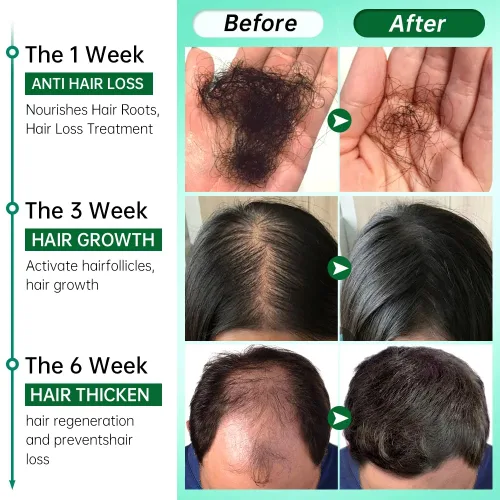 Miniatura 4 de BlueQueen Adivasi - Aceite natural puro para el cabello, hecho por Pure Adivasi, aceite indio para el cabello para hombres y mujeres, aceite bio