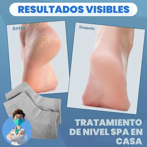 Miniatura 2 de TEAWOO - 6 pares de calcetines hidratantes para talones, calcetines sin dedos con gel para hidratación y reparación de pies secos y agrietados